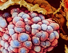 Microscopic view of lung cells
